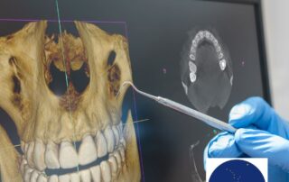 3d image of teeth