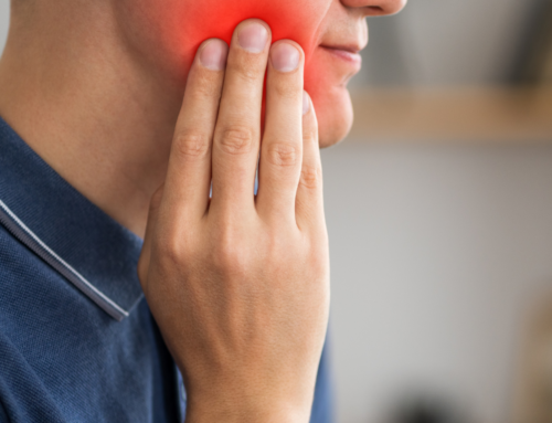 Understanding, Managing, and Extracting Wisdom Teeth