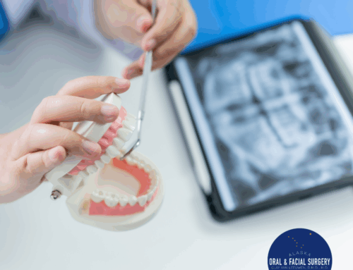 Bone Grafting: What You Should Know