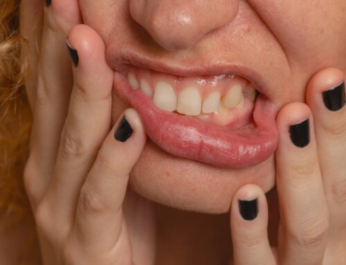 What Happens If You Leave an Impacted Canine Tooth Untreated