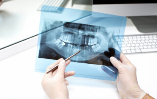 dental bone grafting