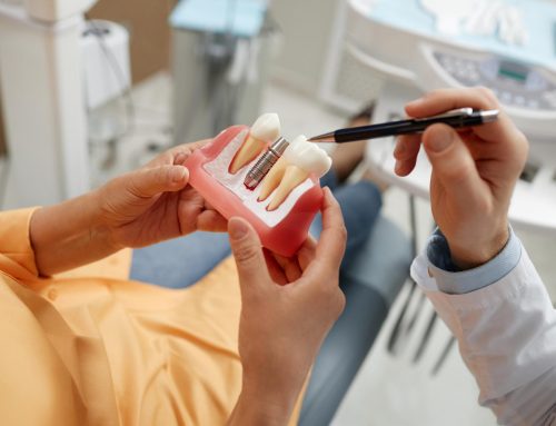 Questioning Dental Implants? When Jaw Surgery Becomes Essential