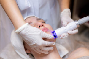 skin reset