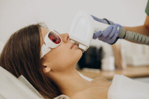 laser facial
