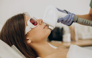 laser facial