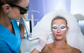 laser skin resurfacing