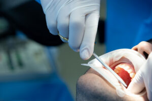 oral surgeon