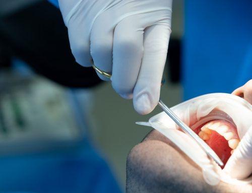 Warning Signs Your Tooth Extraction Needs an Oral Surgeon