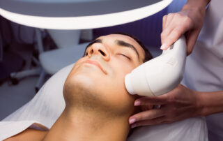 laser skin resurfacing