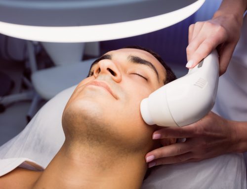 Laser Skin Resurfacing in Fairbanks: Timing, Downtime, and Sun Avoidance