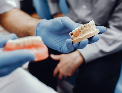 Jaw Bone Grafting Before Implants: Socket Preservation vs Ridge vs Sinus Lift