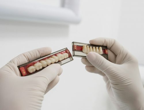 Tooth Replacement After Extraction: Dentures vs. Implants vs. Bridges